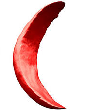 Sickle Cell